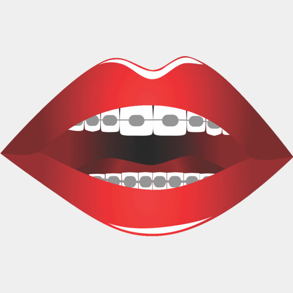 Lips Braces 1 Thumbnail
